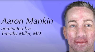 Patients of Courage | Marine Cpl. Aaron Mankin