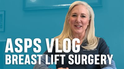 Breast Lift – Inside the OR and FAQs