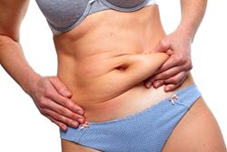 Different tummy tuck techniques