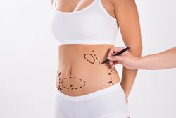 Ultrasonic liposuction vs traditional liposuction